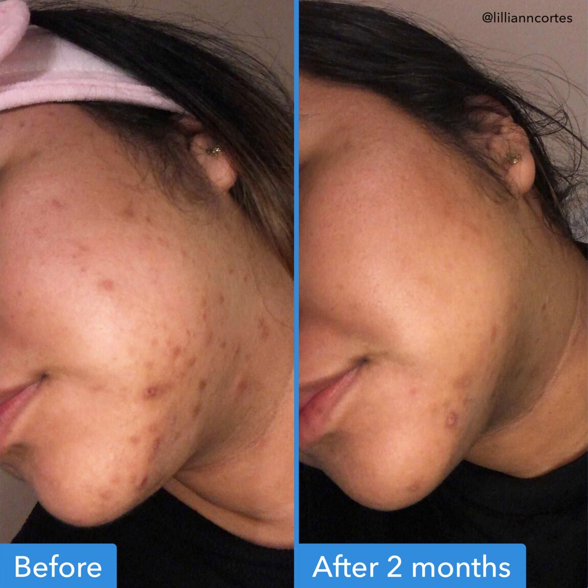 discoloration-correcting-serum-j0 zb_p.jpg