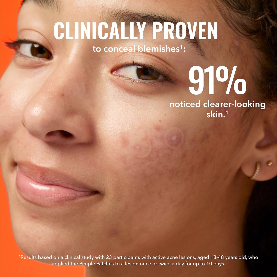 pimple-patches-d8 zb_p.jpg