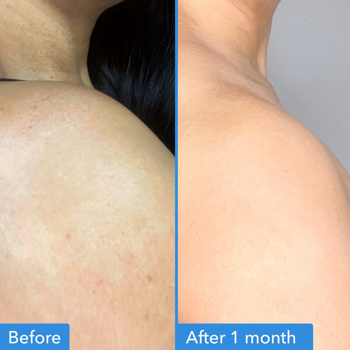 discoloration-correcting-body-treatment-t8 zb_p.jpg