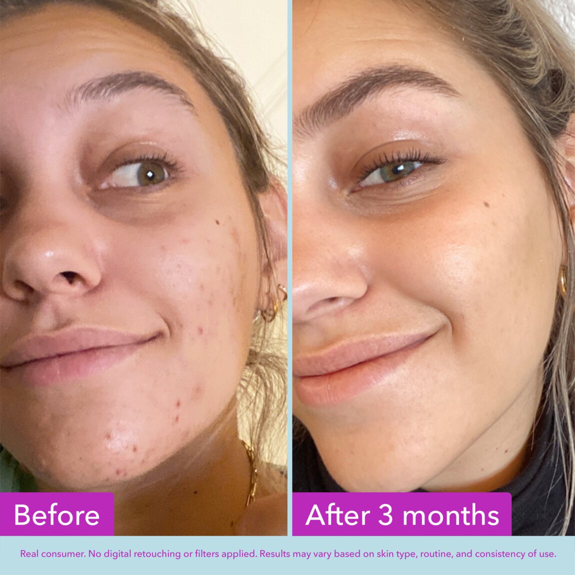 niacinamide-brightening-toner-h7 zb_p.jpg
